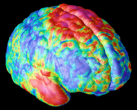 Colored brain