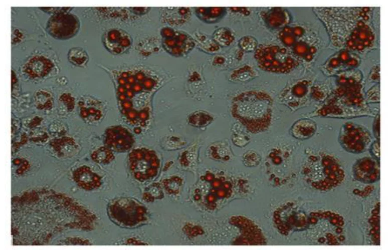 Microscopic image of adipocytes, or fat cells, stained with Oil Red to show lipid droplets.