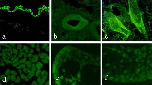Low-density lipoprotein mediated cell transfection