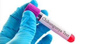 Chikungunya Virus