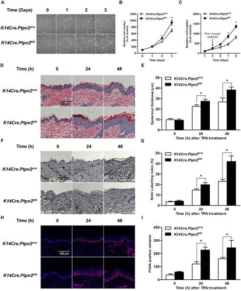 Carcinogenesis Study: