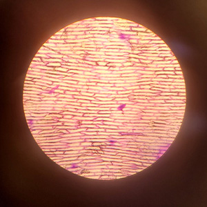 Positive Staining